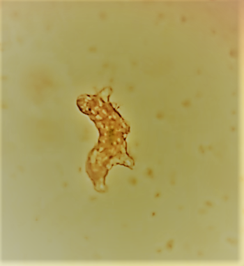 Tardigrade